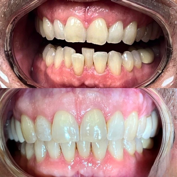 Smile transformation