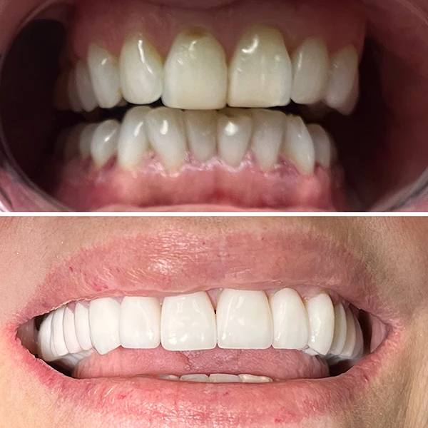 Smile transformation