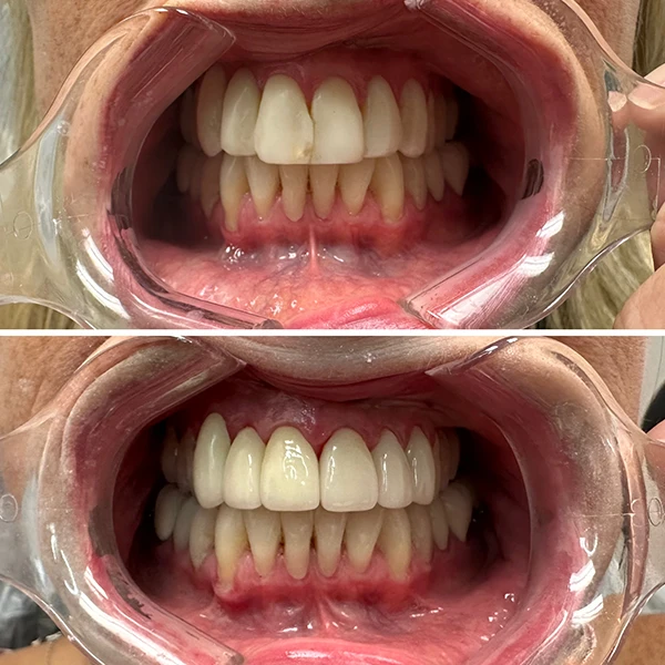 Smile transformation