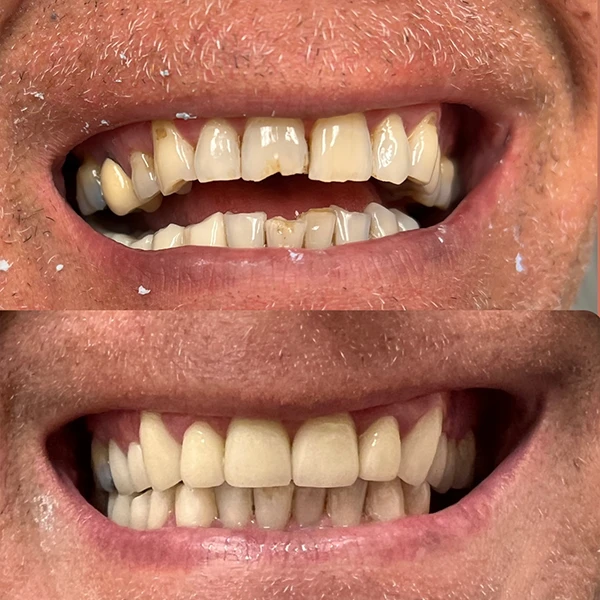 Smile transformation