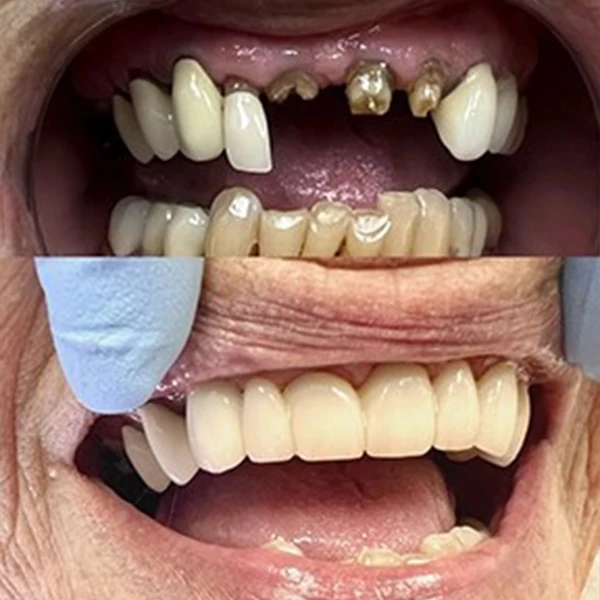 Smile transformation