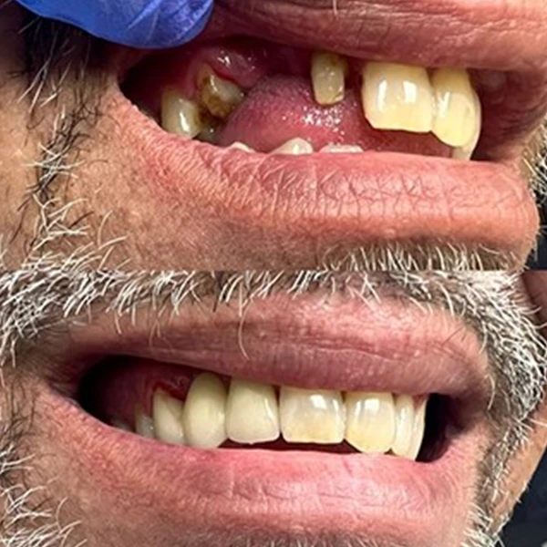 Smile transformation